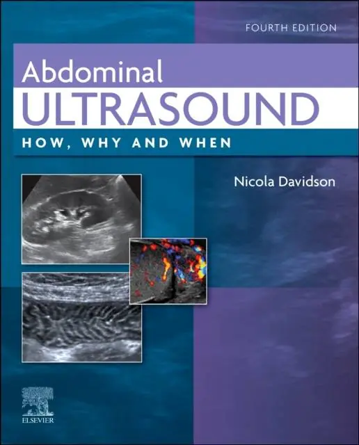 Abdominal Ultrasound / 4th Edition Uitverkoop