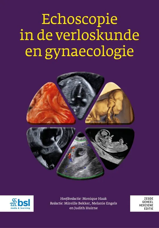 Echoscopie in de verloskunde en gynaecologie / Druk 6 Beste Prijs