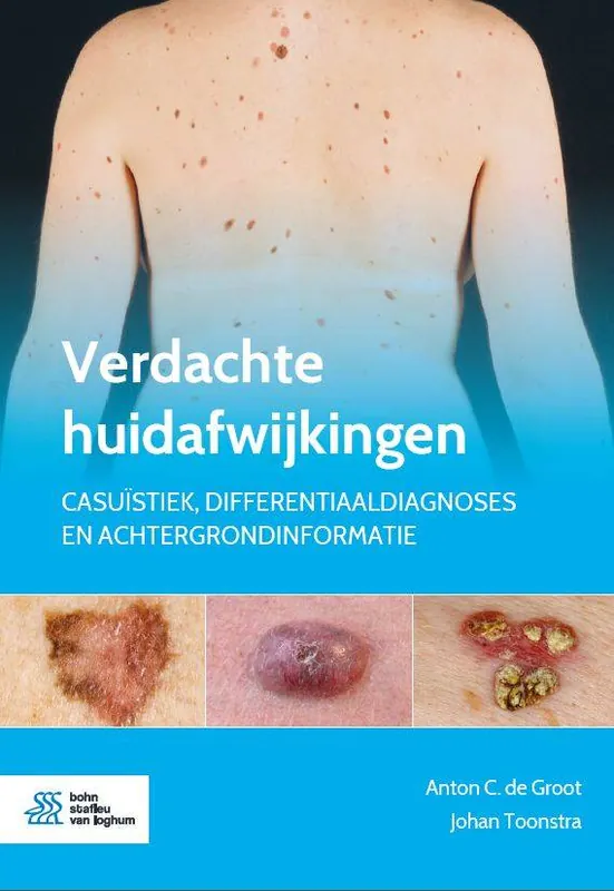Verdachte huidafwijkingen / Druk 1 Laatste Versie