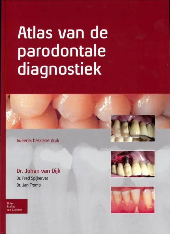 Atlas van de parodontale diagnostiek / Druk 2 Merkproduct