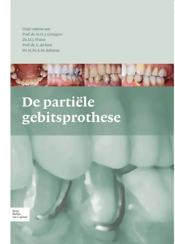 Beste Prijs De partiële gebitsprothese / Druk 3