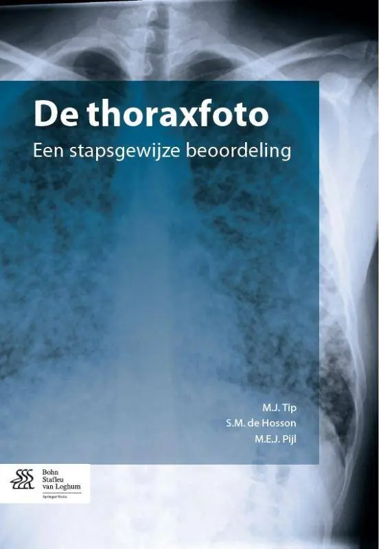Koop Vandaag De thoraxfoto