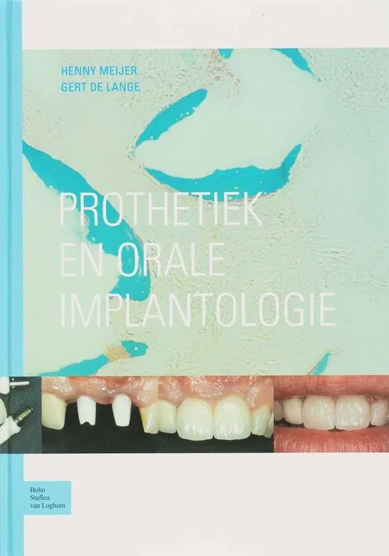Prothetiek en orale implantologie / Druk 1 Weekendaanbieding