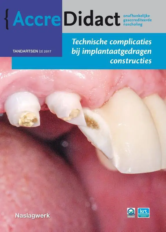 Uitverkoop Technische complicaties bij implantaatgedragen constructies / Druk 1