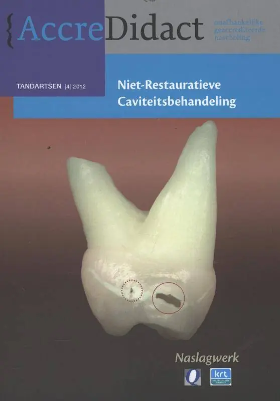 Fabrieksprijs Niet-restauratieve caviteitsbehandeling / Druk 1