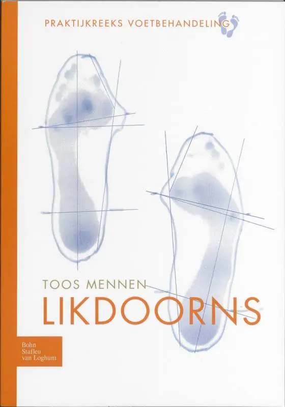 Likdoorns / Druk 1 Nu Kopen