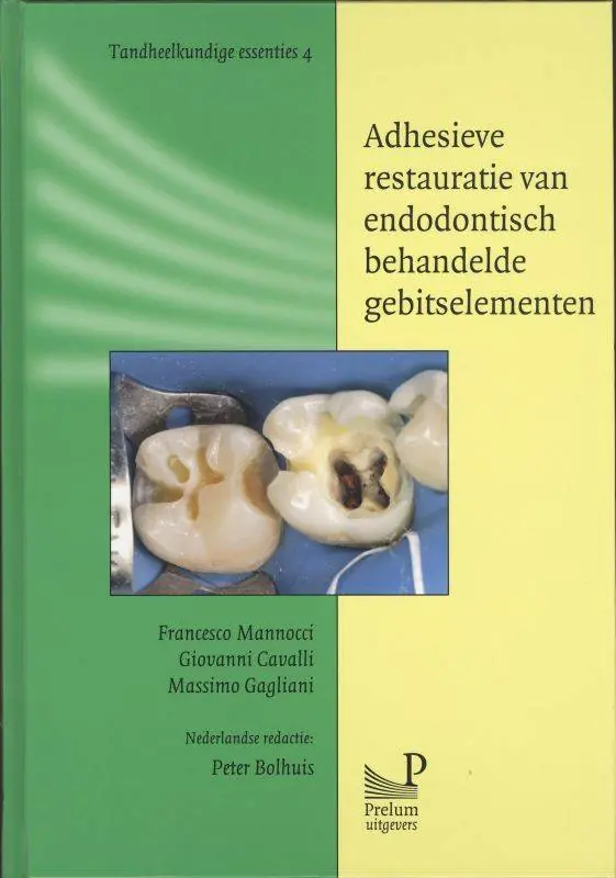 Adhesieve restauratie van endodontisch behandelde gebitselementen / Druk 1 Snelle Levering