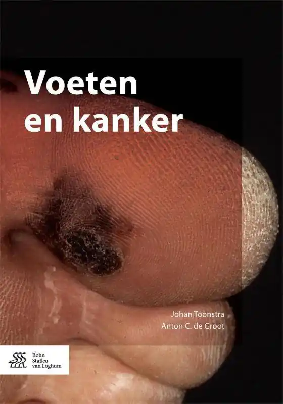 Bestseller Voeten en kanker / Druk 1