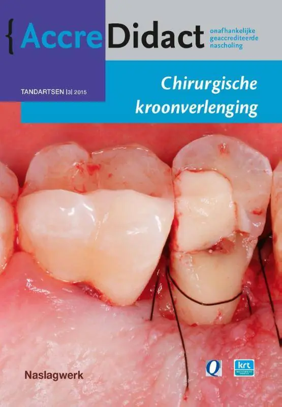 Chirurgische kroonverlenging / Druk 1 Gecertificeerd