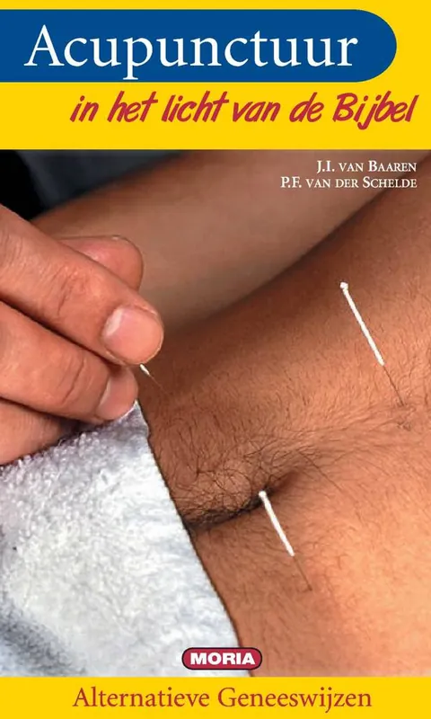 Acupunctuur / Druk 3 Betaalbaar